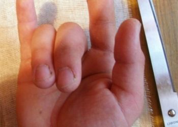 Школьник отрезал себе палец, споря о вреде видеоигр