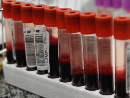 Кабмин Украины разрешил геям, наркоманам и проституткам быть донорами крови